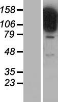 STARD13 Human Over-expression Lysates NM_178006