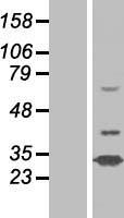 N42L1 (N4BP2L1) Human Over-expression Lysates NM_052818