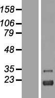 ZFAND2A Human Over-expression Lysates NM_182491