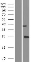 TGIF2LY Human Over-expression Lysates NM_139214
