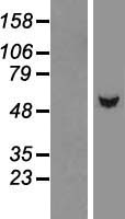 ls090665 tbl1y human over expression lysates nm 033284 wb testing 1