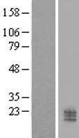 ls090693 ccdc126 human over expression lysates nm 138771 wb testing 1