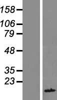 FAM104B Human Over-expression Lysates NM_138362