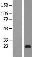 PAGE5 Human Over-expression Lysates NM_130467