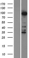 ZNF598 Human Over-expression Lysates NM_178167