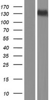 SPOCD1 Human Over-expression Lysates NM_144569
