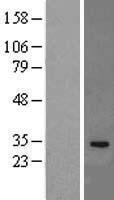 IL33 Human Over-expression Lysates NM_033439