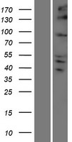 ls090990 kifc2 human over expression lysates nm 145754 wb testing 1