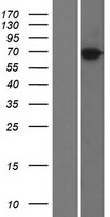 TRIM47 Human Over-expression Lysates NM_033452