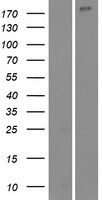 NUP210L Human Over-expression Lysates NM_207308