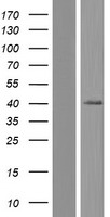 SLC39A13 Human Over-expression Lysates NM_001128225