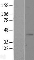 SLC39A13 Human Over-expression Lysates NM_152264