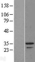 ls091283 c9orf30 msantd3 human over expression lysates nm 080655 wb testing 1