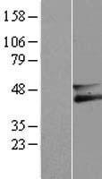 ls091304 membralin tmem259 human over expression lysates nm 033420 wb testing 1