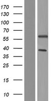 UAP1L1 Human Over-expression Lysates NM_207309