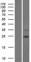 RNF185 Human Over-expression Lysates NM_001135824