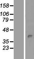 Protein kinase like protein SgK493 (PKDCC) Human Over-expression Lysates NM_138370