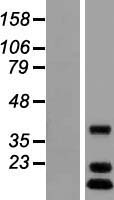C12orf65 Human Over-expression Lysates NM_001143905