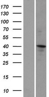 ls091603 ccdc16 znf830 human over expression lysates nm 052857 wb testing 1