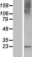 RASL10B Human Over-expression Lysates NM_033315