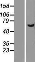 DEPDC7 Human Over-expression Lysates NM_001077242