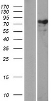 Nexilin (NEXN) Human Over-expression Lysates NM_144573