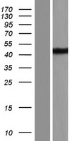 TDRD12 Human Over-expression Lysates NM_001110822