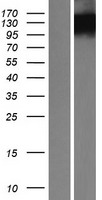 BOC Human Over-expression Lysates NM_033254