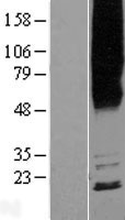 MYADM Human Over-expression Lysates NM_001020819