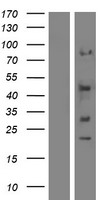 SYT12 Human Over-expression Lysates NM_177963