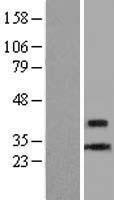 CENPL Human Over-expression Lysates NM_033319