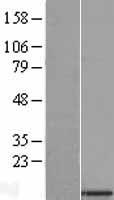 ls091689 c22orf32 smdt1 human over expression lysates nm 033318 wb testing 1