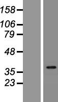 IDI2 Human Over-expression Lysates NM_033261