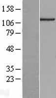 C14orf43 (ELMSAN1) Human Over-expression Lysates NM_001043318
