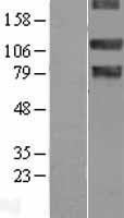 NEK9 Human Over-expression Lysates NM_033116