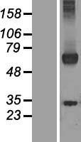 WDR20 Human Over-expression Lysates NM_144574