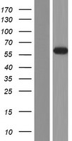 WDR20 Human Over-expression Lysates NM_181308