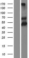TIM 4 (TIMD4) Human Over-expression Lysates NM_001146726
