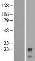 CTBP1-DT Human Over-expression Lysates NM_052861