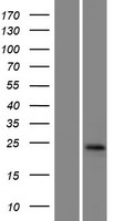 GGTLC1 Human Over-expression Lysates NM_178311