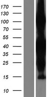 ls092092 zc3hav1l human over expression lysates nm 080660 wb testing 1