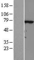 TTC30A Human Over-expression Lysates NM_152275