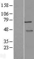 LYRIC (MTDH) Human Over-expression Lysates NM_178812