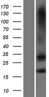 TMEM88 Human Over-expression Lysates NM_203411