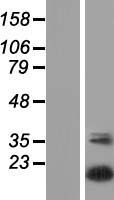 UBTD2 Human Over-expression Lysates NM_152277