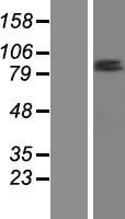 ls092285 znf585b human over expression lysates nm 152279 wb testing 1