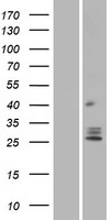 TMEM129 Human Over-expression Lysates NM_138385
