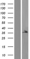 LYK5 (STRADA) Human Over-expression Lysates NM_001165969