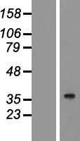 ls092335 lyk5 strada human over expression lysates nm 153335 wb testing 2