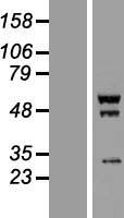 SCYL1BP1 (GORAB) Human Over-expression Lysates NM_152281